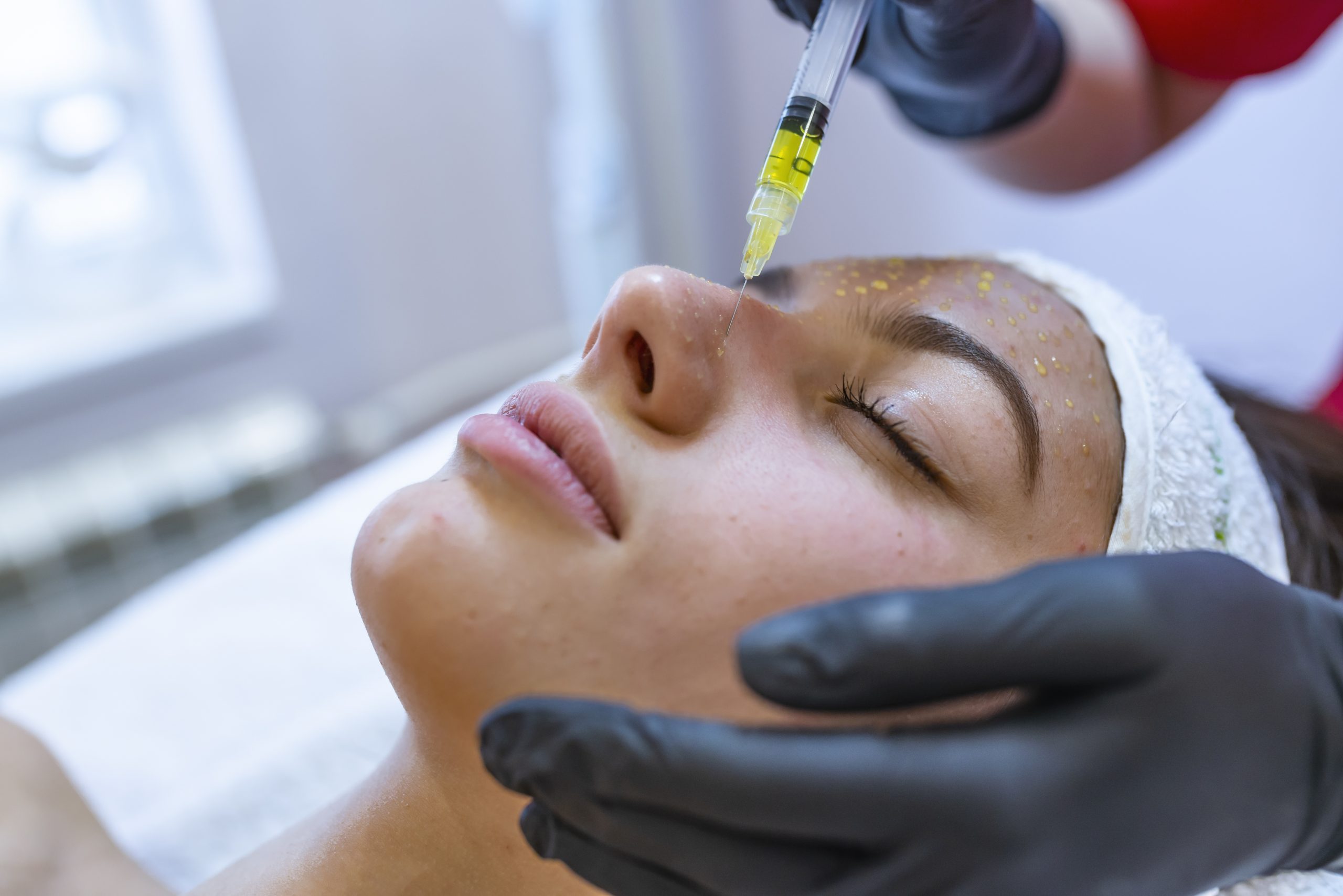 Mesotherapy – The Skin Sanctuary